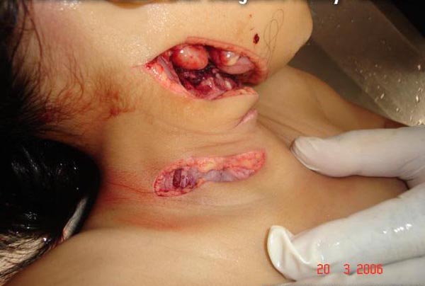 Name:  pic16118.jpg
Views: 495
Size:  48.8 KB