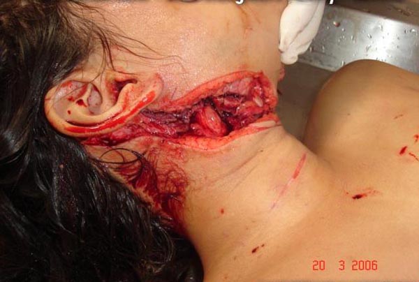 Name:  pic26777.jpg
Views: 486
Size:  59.2 KB